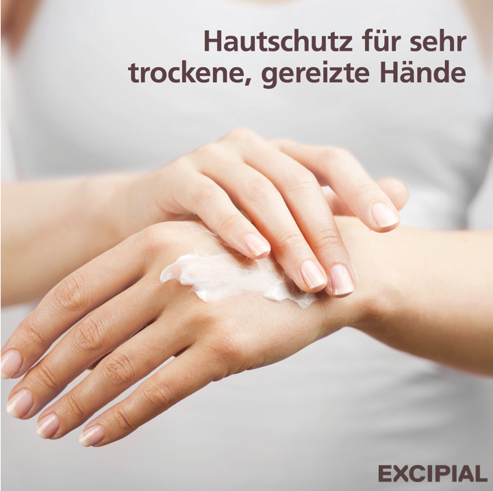 Hände mit Schmutz und Rötungen nach Gartenarbeit. Strapazierte Hände?